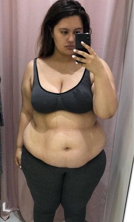 Ես ատում էի իմ մարմինը ավելորդ կիլոգրամների պատճառով